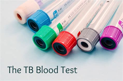 Friday: 7 a. . Labcorp tb test